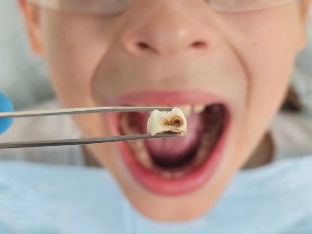 Best Emergency Dental Care for Sports Injuries in Stony Point, MI