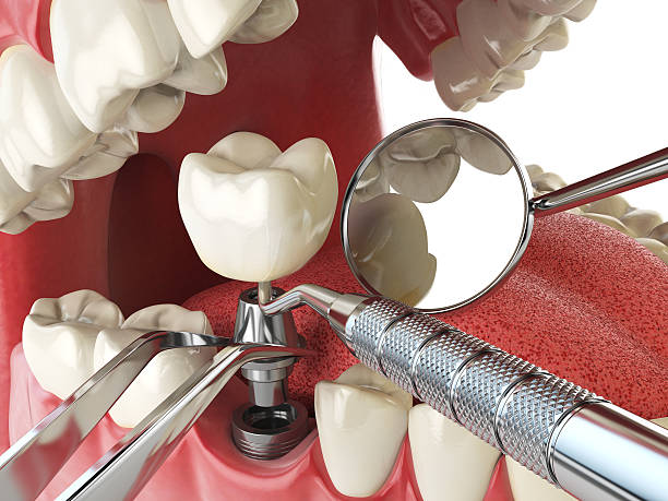 Best Emergency Care for Gum Disease in Stony Point, MI